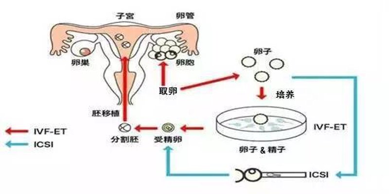 成都试管婴儿技术的发展与应用